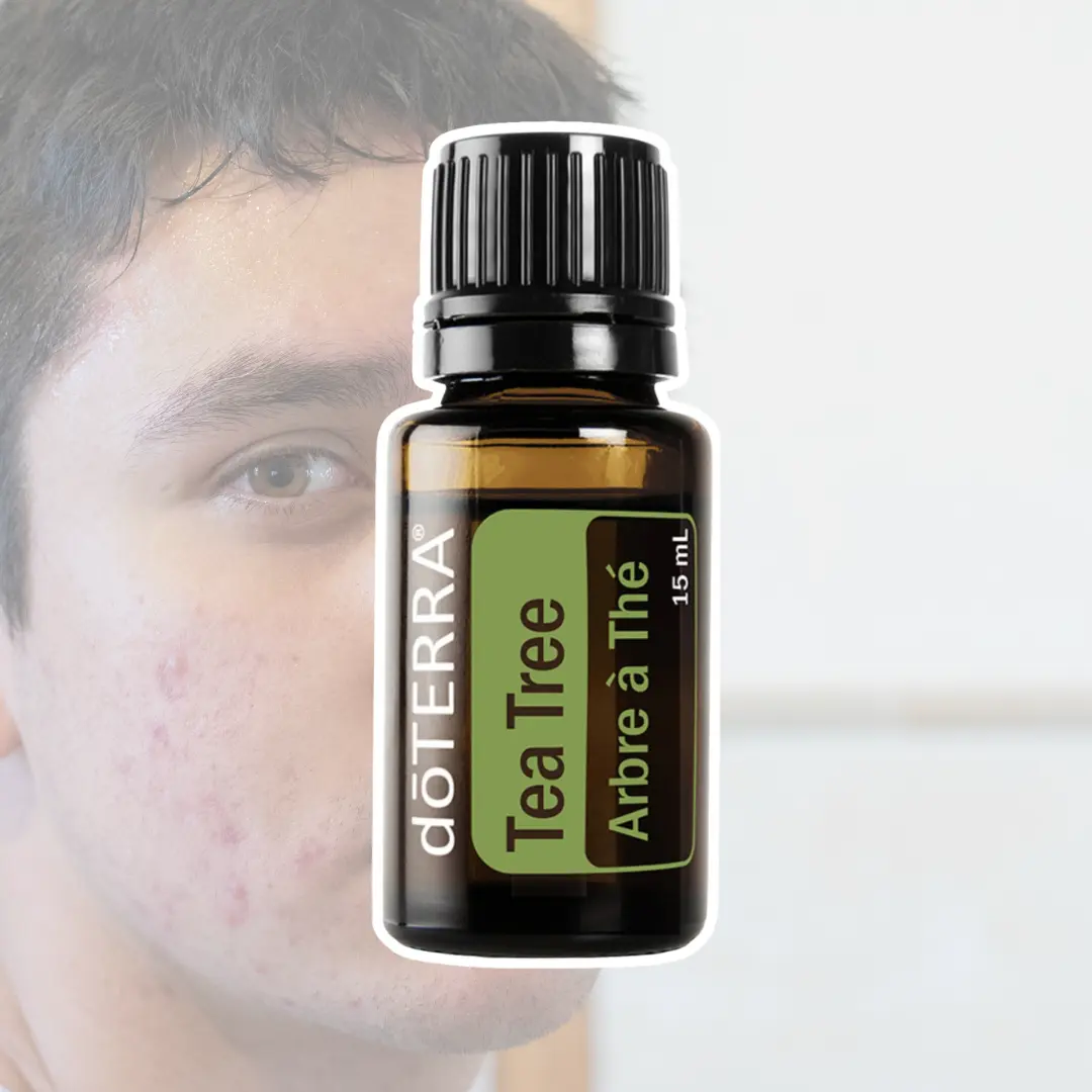 Café aroma par le CLME avec Deborah Haouzi pour trouver des solutions naturelle en cas de peau acnéique