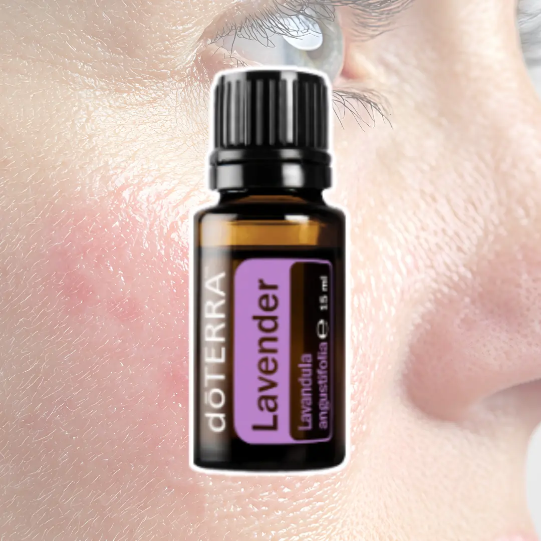 Café aroma par le CLME avec Deborah Haouzi pour trouver des solutions naturelle en cas de peau sensible