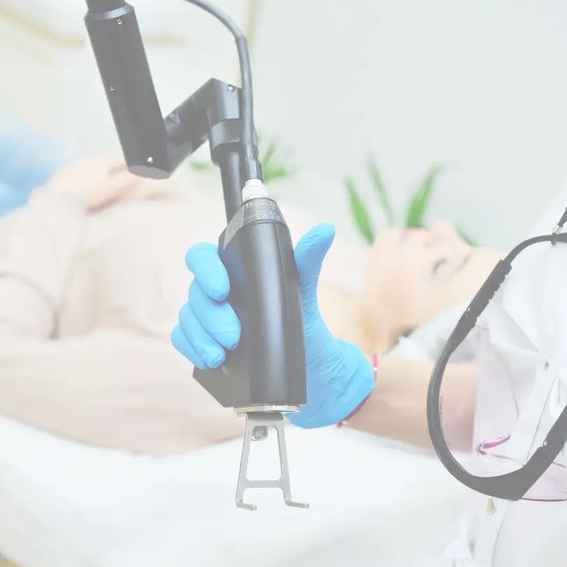 Epilation durable au laser CO2 au CLME