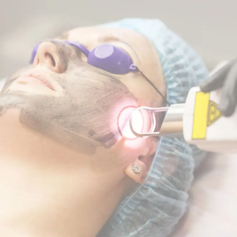 Traitement au charbon actif au CLME